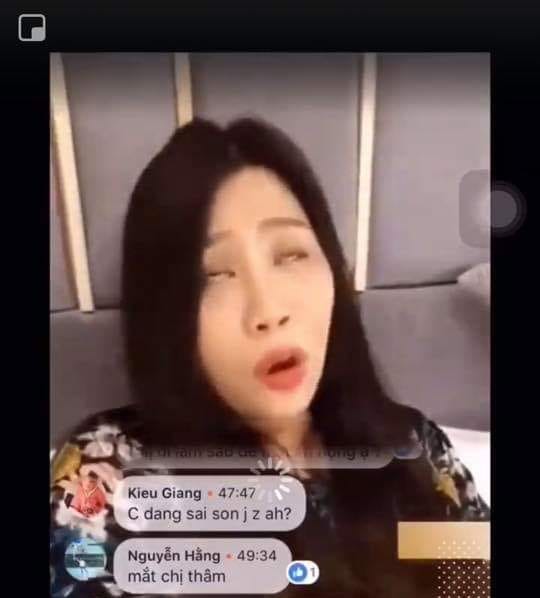 anh xau 2