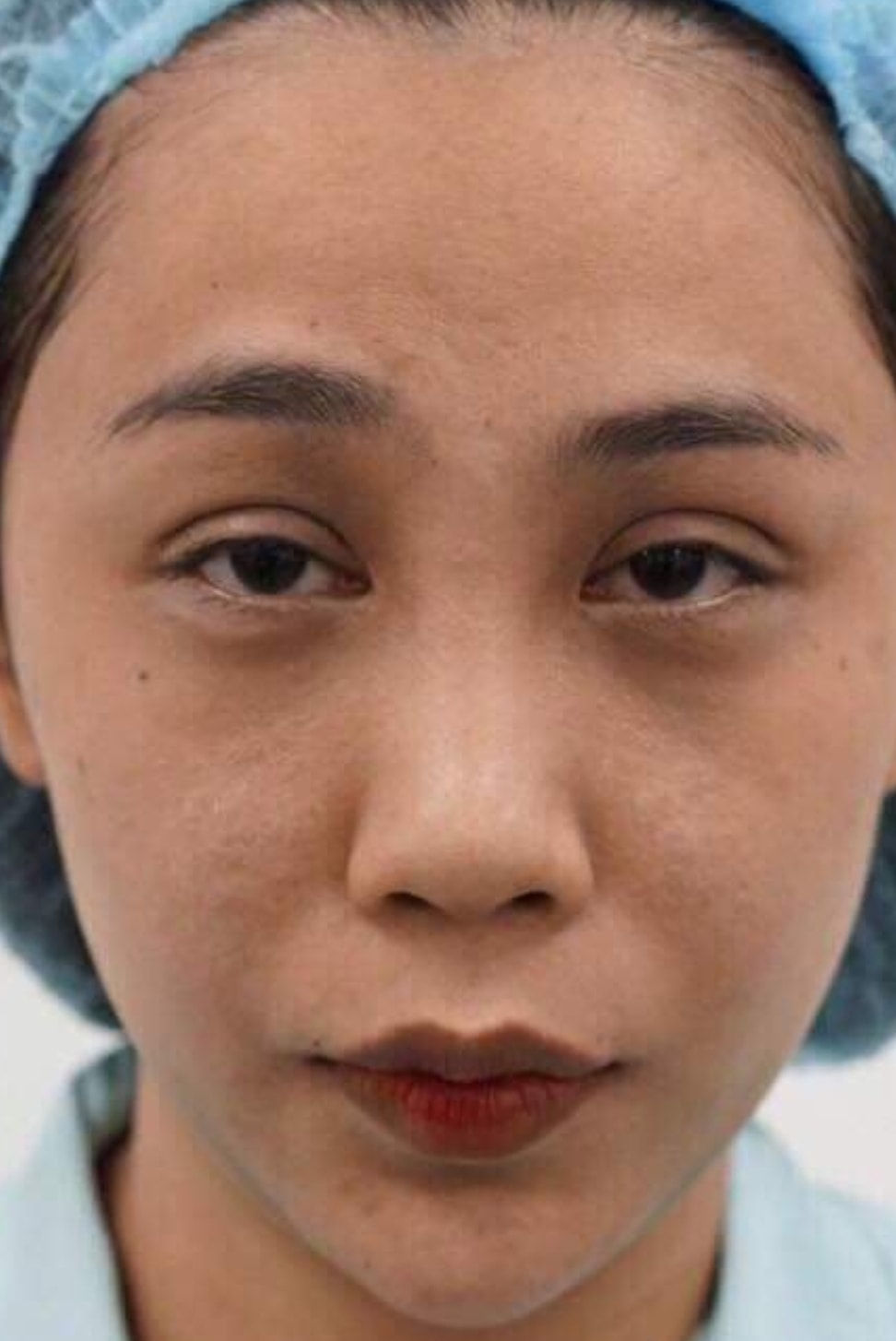 anh xau 5 copy